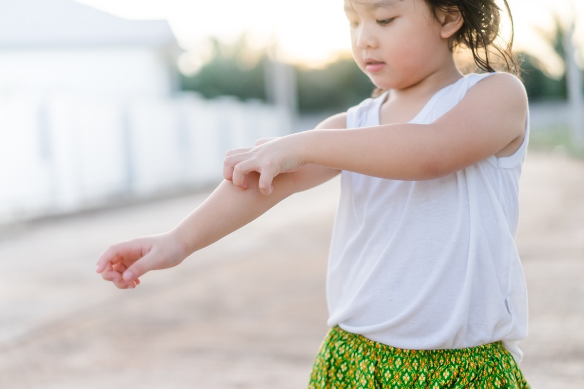 little girl scratching her arm