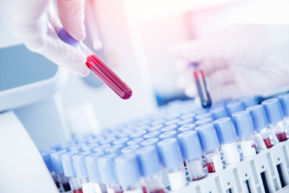 Lab worker preparing test blood for detection of antibodies and infections