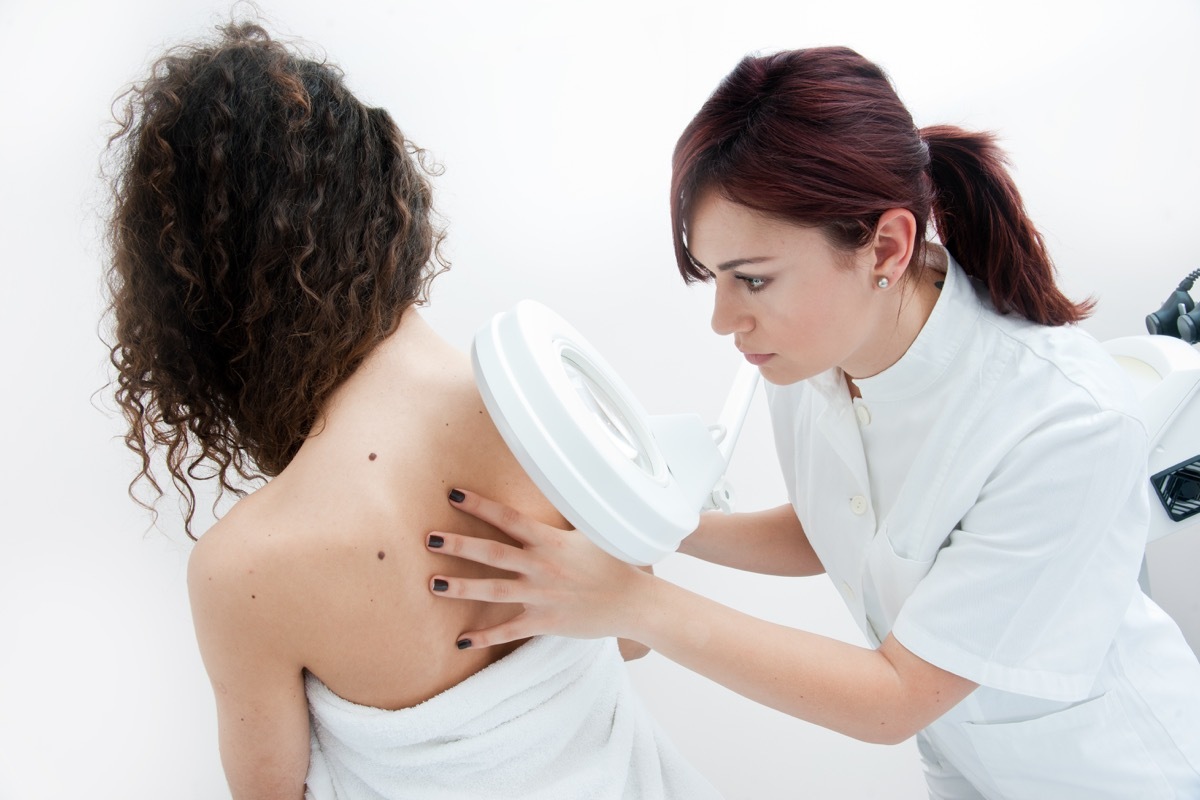 dermatologist doctor inspecting woman skin for moles and melanoma