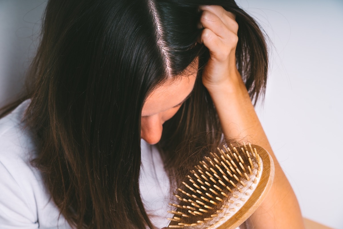 Young woman with hair loss problem. Hair falling out. Hair brush with hair