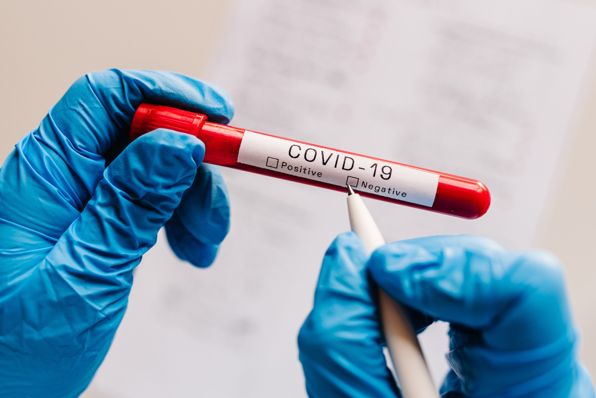 The glove-covered hands of doctor, nurse, or scientist writing with a pen on a vial of a covid test, confirming a negative result