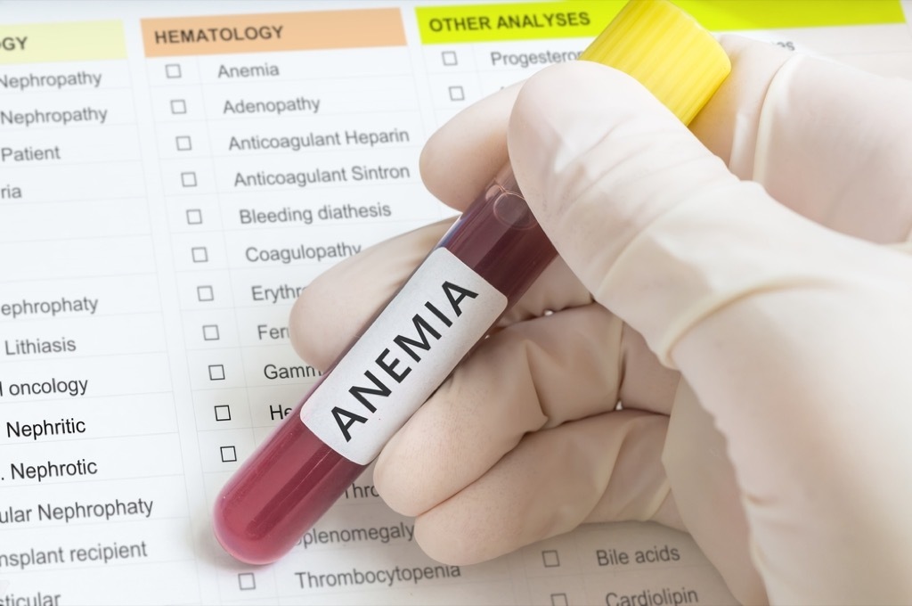 iron deficiency blood test