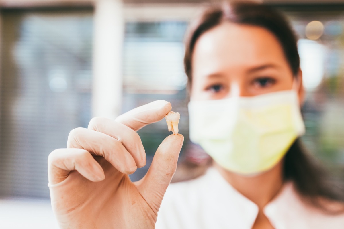 doctor holding tooth